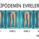Sağlık Üzerine...Tek hapla mucize yok...