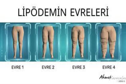 Sağlık Üzerine...Tek hapla mucize yok...